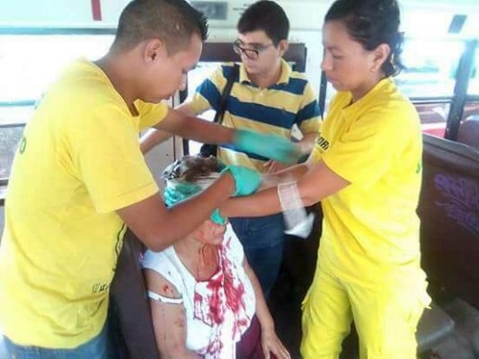 DES BUS EN COLLISION FONT 8 BLESSÉS